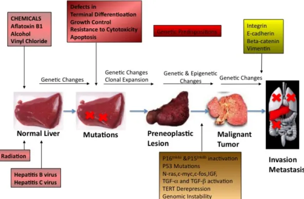 Figure 1.1.1 Multistages and contributing factors of hepatocellular carcinoma. Modified from [14]