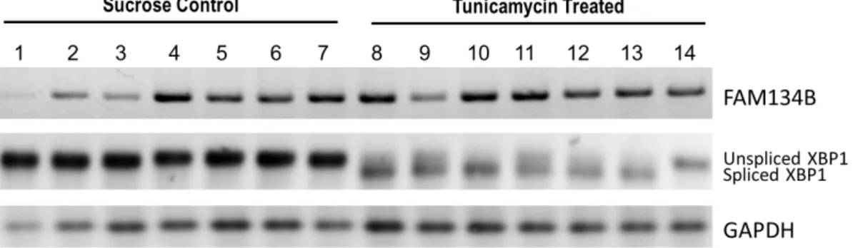 Figure 4.4:  ER stress induction by 8 hours of 1ug/g body weight tunicamycin treatment does  not affect the protein levels of FAM134B significantly in liver tissues of  mice