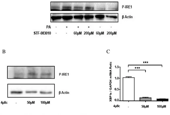 Figure 3.4. IRE1 RNase inhibitors, STF-083010 and 4µ8c, successfully inhibit IRE1  RNase function without affecting IRE1 kinase function