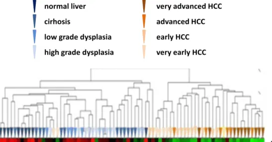 Figure 4.2: Microarray data of different liver conditions for JMJD5 levels   (Red indicates upregulation, and green indicates downregulation of the gene.) 