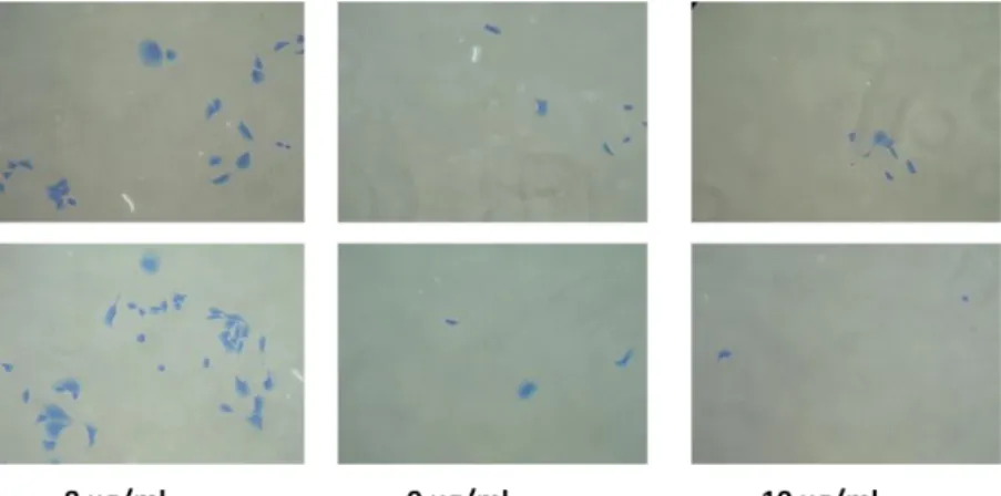 Figure 4.9: Commassie Brilliant Blue staining of untransfected SNU449-TRex cells incubated in  different concentrations of puromycin for 6 days  
