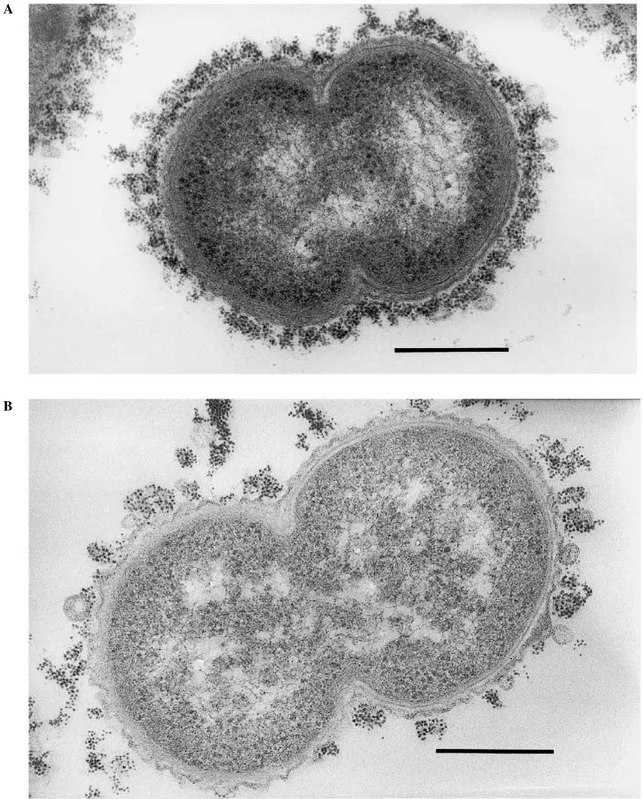 Fig. 1. Transmission electron microscopic photo of M. catarrhalis after treatment with cationized ferritin
