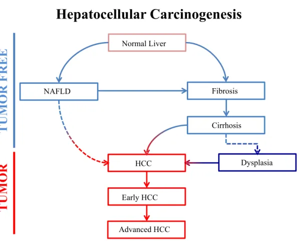 Figure  1.1:  Steps  of  the  hepatocellular  carcinogenesis:  A  normal  healthy  liver  can  transform into non-alcohol induced liver disease (NAFLD) or fibrosis