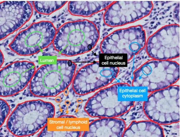Figure 1.1: Sample colon tissue image, on which tissue components are illustrated.
