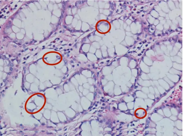 Figure 1.2: Sample colon tissue image which contains white gaps in between epithelial nuclei due to imperfection in the tissue preparation process.