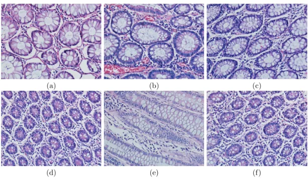 Figure 2.2: Examples of colon tissues containing gland structures.