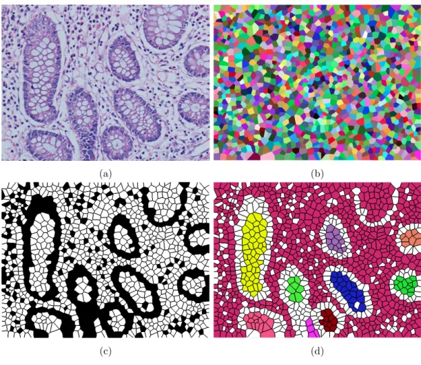 Figure 3.2: Steps of generating the Voronoi representation: (a) Histopathological image, (b) Voronoi diagram of the given image, (c) labeled Voronoi polygons, and (d) connected components generated from white Voronoi polygons.