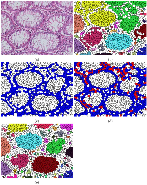 Figure 3.6: Steps of the candidate set generation: (a) Histopathological image, (b) white connected components, (c) nuclear Voronoi polygons before the conversion method, (d) nuclear Voronoi polygons after the conversion method, and (e) white connected com