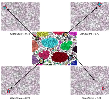 Figure 3.9: These are some of the examples which are eliminated through area thresholding