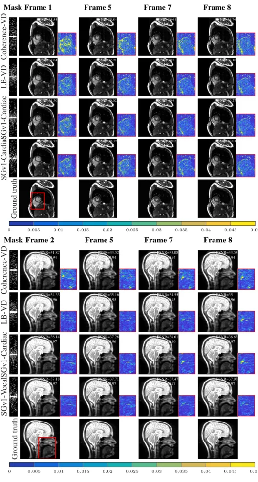 Fig. 13: Reconstruction with KTF [7] at 15% sampling rate for the cardiac anatomy of size 256×256×10