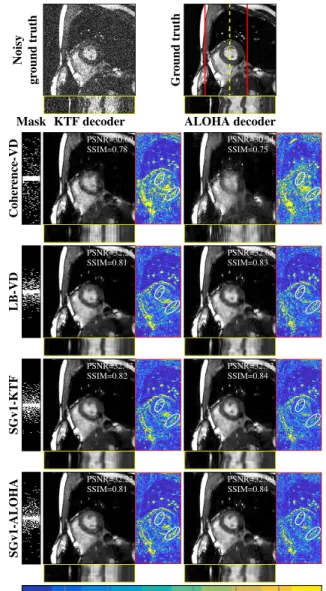 Fig. 16: Reconstructed denoised version from the noisy ground truth on the first line, at 15% sampling