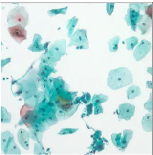 Figure 3.1: An example Pap smear image with its characteristic problems such as inhomogeneous staining, overlapping cells.