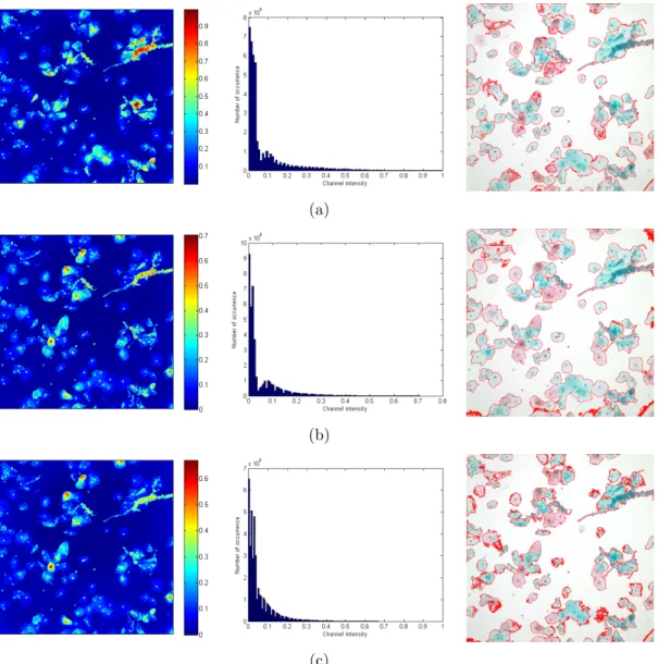 Figure 3.6: Illumination-corrected channels of RGB color space, their histograms and segmentation results (a) R channel (b) G channel (c) B channel.