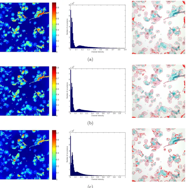 Figure 3.7: Illumination-corrected channels of CIE XYZ color space, their his- his-tograms and segmentation results (a) X channel (b) Y channel (c) Z channel.