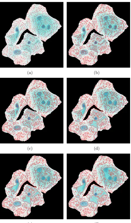 Figure 3.9: Candidate segments obtained by morphological profiles of closing by reconstruction (a) at SE size 1 (b) at SE size 4 (c) at SE size 7 (d) at SE size 10 (e) at SE size 13 (f) at SE size 15.