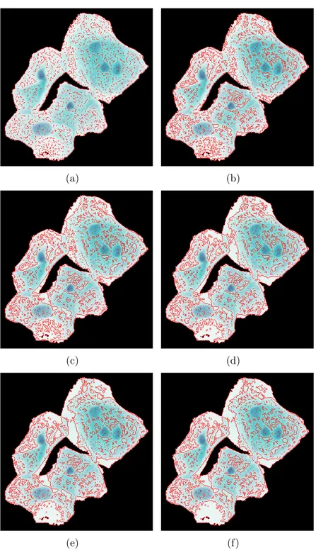 Figure 3.10: Candidate segments obtained by morphological profiles of opening by reconstruction (a) at SE size 1 (b) at SE size 4 (c) at SE size 7 (d) at SE size 10 (e) at SE size 13 (f) at SE size 15.