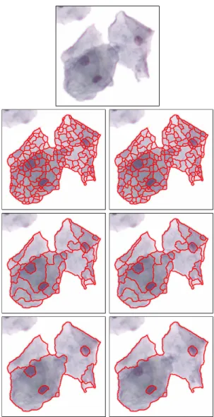 Figure 1 shows the multi-scale watershed partitioning of an example cell image at six different scales