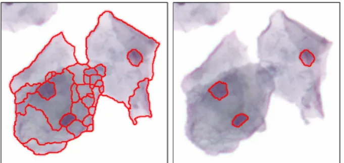 Figure 2. Segmentation (left) and classification (right) of an example image. Only the boundaries of nucleus regions are shown on the right.