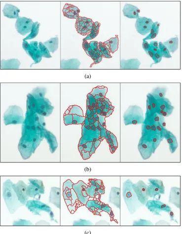 Figure 4. Example segmentation and classification results for the Hacettepe data.