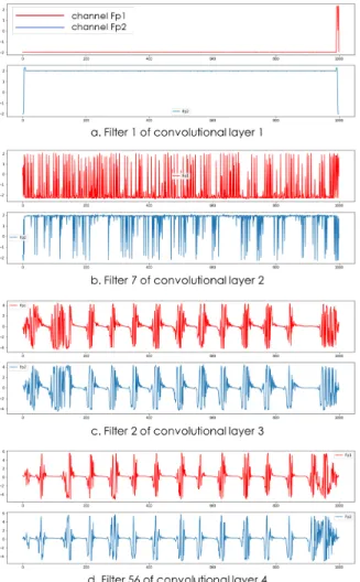 Fig. 3. Examples of seizure waveforms (3 seconds)