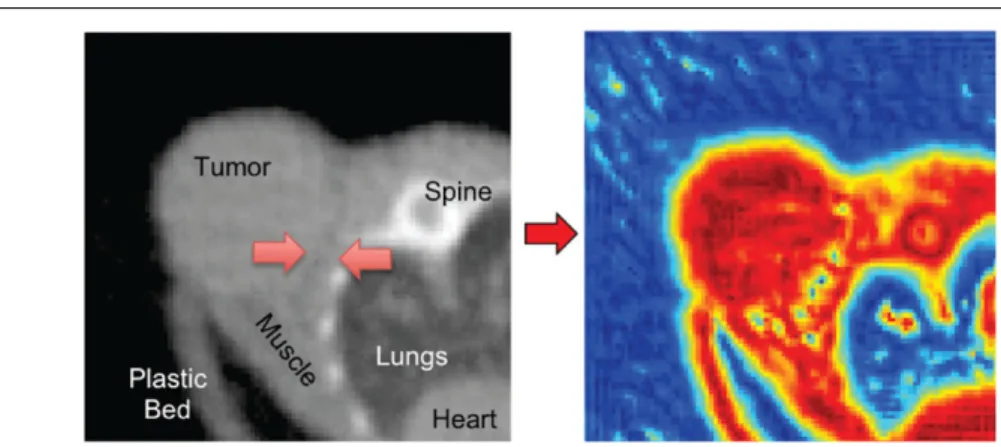 Figure 4. An axial microCT slice of a subcutaneous tumour (left), and its corresponding local phase map (right)