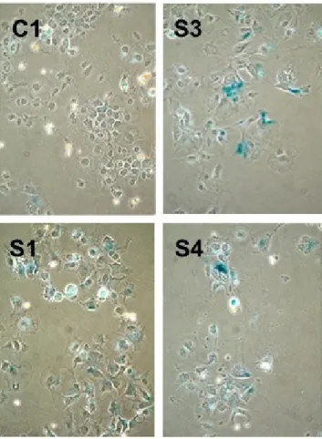 Figure 4.4: ZEB2-expressing clones display positive staining for SABG. Senescent cells (blue) were abundant in ZEB2-expressing S1, S3 and S4 clones, but not in C1 clone