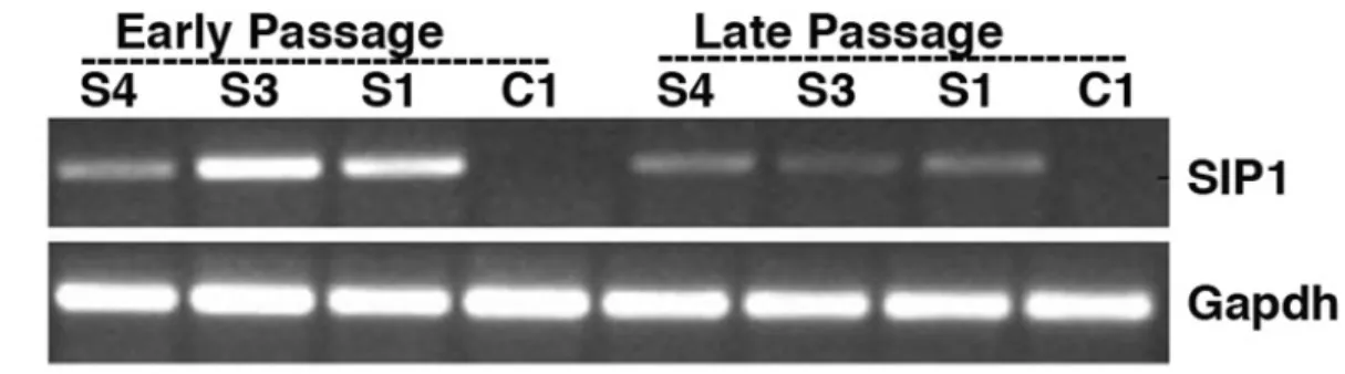 Figure 4.10: In vitro expansion of S1, S3 and S4 clones is not compatible with ZEB2 overexpression