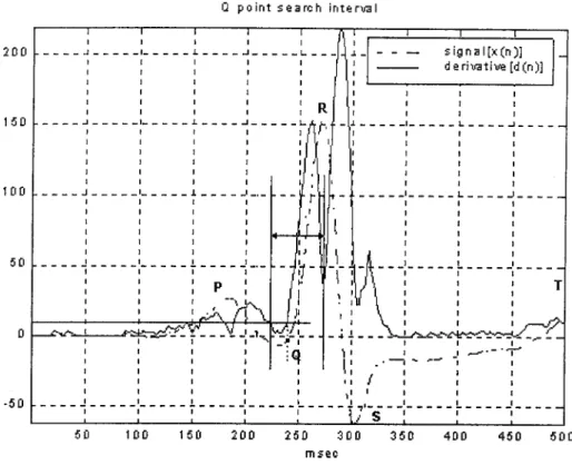 Figure  2.3:  Q  point  detection.