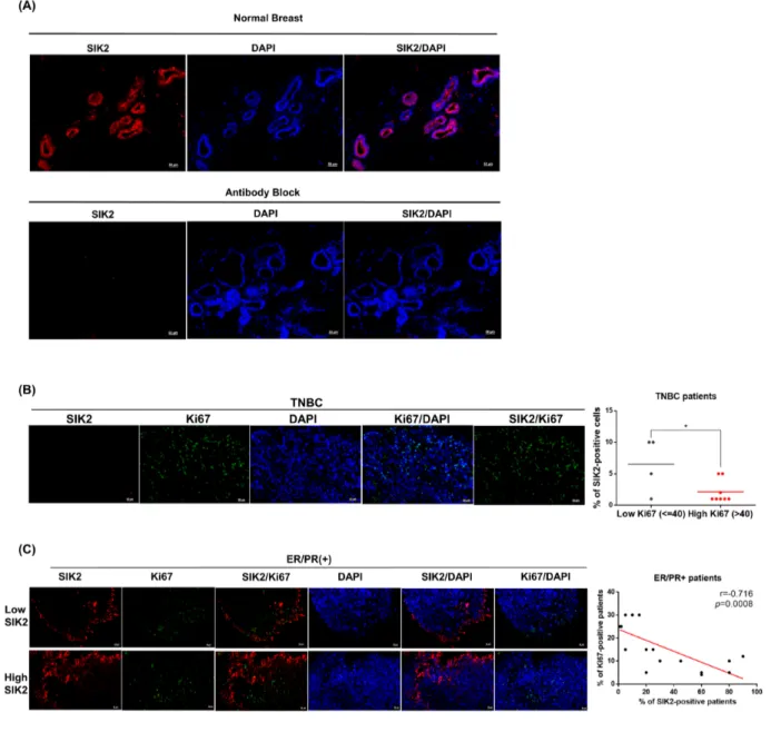 Figure 5: SIK2 protein expression is frequently downregulated in breast tumors and negatively correlated with  mitotic activity of the breast cells