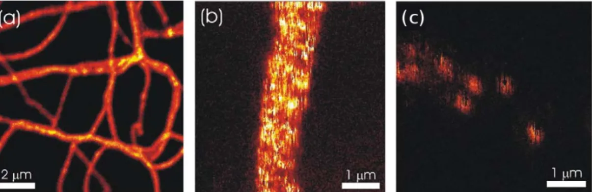 Figure 2.7: Some of the results gotten by Tomzcak et al. Scanning confocal