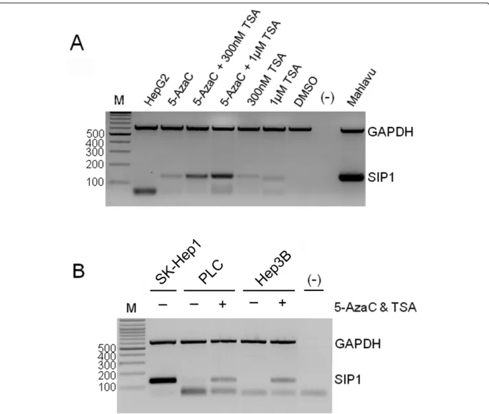 Figure 4 Treatment with 5-AzaC and TSA rescues SIP1 expression in HCC cell lines. The restoration of SIP1 expression is analyzed by multiplex semi-quantitative RT-PCR