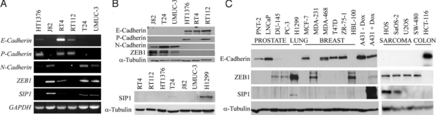 Fig. 2. ZEB family members are differentially expressed in cultured cancer cells. (A) Transcription of genes coding for cadherins and ZEB family members was analyzed in bladder cancer cell lines by semi quantitative RT-PCR