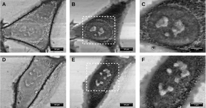 Figure 3.4. SEM images of WM115 (a, b and c) and WM266-4 (d, e and f) melanoma cells  cultured on bare silicon surface, recorded at 2kV (a, d) and 5 kV (b, c, e and f)