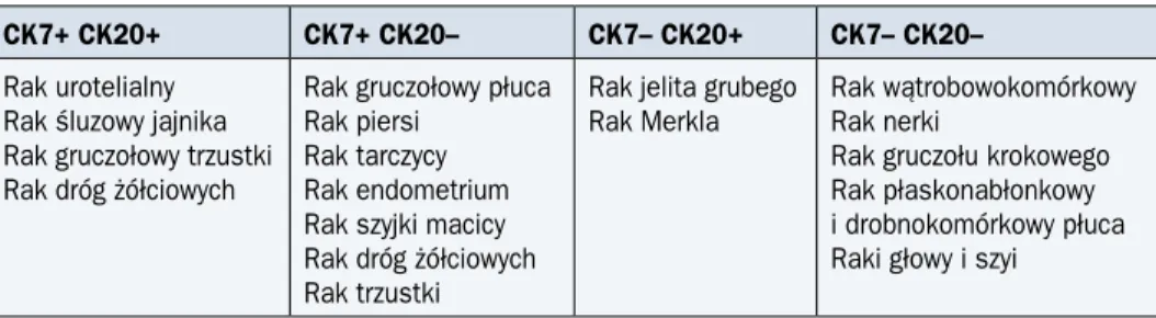Tabela 1. Interpretacja reakcji barwnej w ustaleniu lokalizacji pierwotnej nowotworu   o nieznanym umiejscowieniu przy użyciu CK7 i CK20 (trzeci etap — wybrane przykłady)
