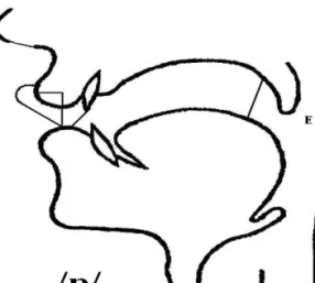 Rysunek 1. Symboliczne oznaczenie dyslokacji przy realizacji fonemu /p/ u osób z rozszczepem  podniebienia