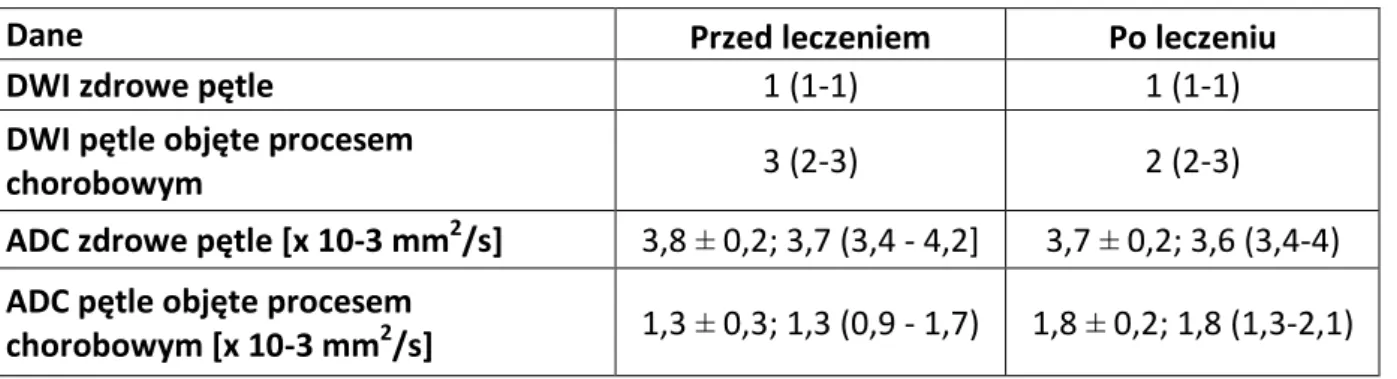 Tabela 6. Ocena aktywności choroby Leśniowskiego-Crohna. 
