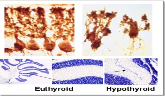 FIGURE 3 - Myelination in the anterior commissure of euthyroid and hypothyroid rats. 