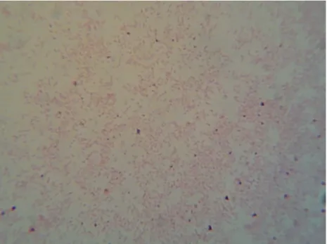 Fot. 7. Porphyromonas gingivalis w preparacie mikroskopowym barwionym metodą Grama (pow