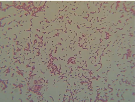 Fot. 9. Aggregatibacter actinomycetemcomitans w preparacie mikroskopowym barwionym metodą  Grama (pow