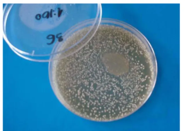 Figure 1: Total number of bacteria in the hospital air  (Columbia agar medium).