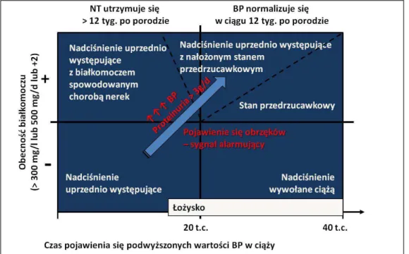 Tabela 1. Klasyfikacja nadciśnienia tętniczego w zależności od wartości BP (wg PTNT 2011)
