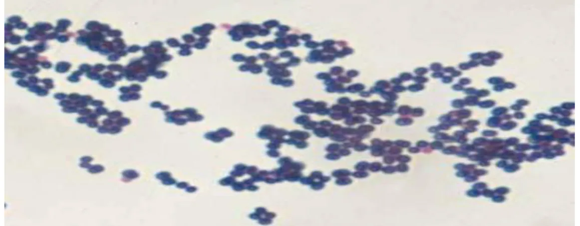 Fot. 1.  Staphylococcus aureus preparat barwiony metodą Grama. 
