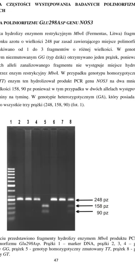 Fot.  1.  Na  zdjęciu  przedstawiono  fragmenty  hydrolizy  enzymem  MboI  produktu  PCR  genu  NOS3  dla  polimorfizmu  Glu298Asp