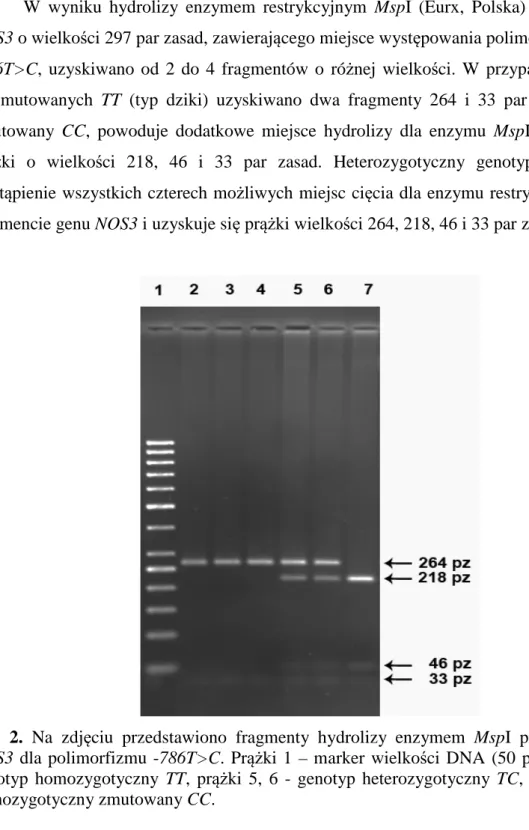 Fot.  2.  Na  zdjęciu  przedstawiono  fragmenty  hydrolizy  enzymem  MspI  produktu  PCR  genu  NOS3  dla  polimorfizmu  -786T&gt;C