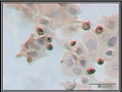 Figura 4.11. Immunocytochemiczna obecność MnSOD w komórkach MCF-7, (warunki doświadczenia: inkubacja 18 godz