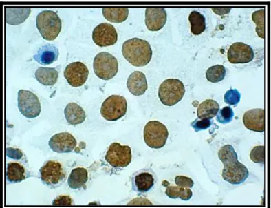 Figura 4.21. Apoptoza w komórkach MCF-7 inkubowanych 18 godz. z Ph-20 µg i 2-Me-50 µM, 6 godz