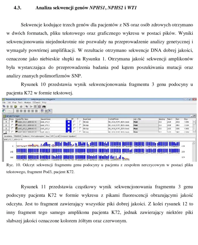 Rysunek  10  przedstawia  wynik  sekwencjonowania  fragmentu  3  genu  podocyny  u  pacjenta K72 w formie tekstowej