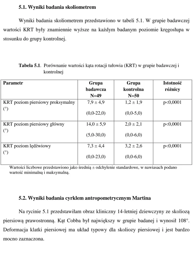 Tabela 5.1.  Porównanie wartości kąta rotacji tułowia (KRT) w grupie badawczej i  kontrolnej  Parametr  Grupa  badawcza  N=49  Grupa  kontrolna N=50  Istotność różnicy  KRT poziom piersiowy proksymalny 