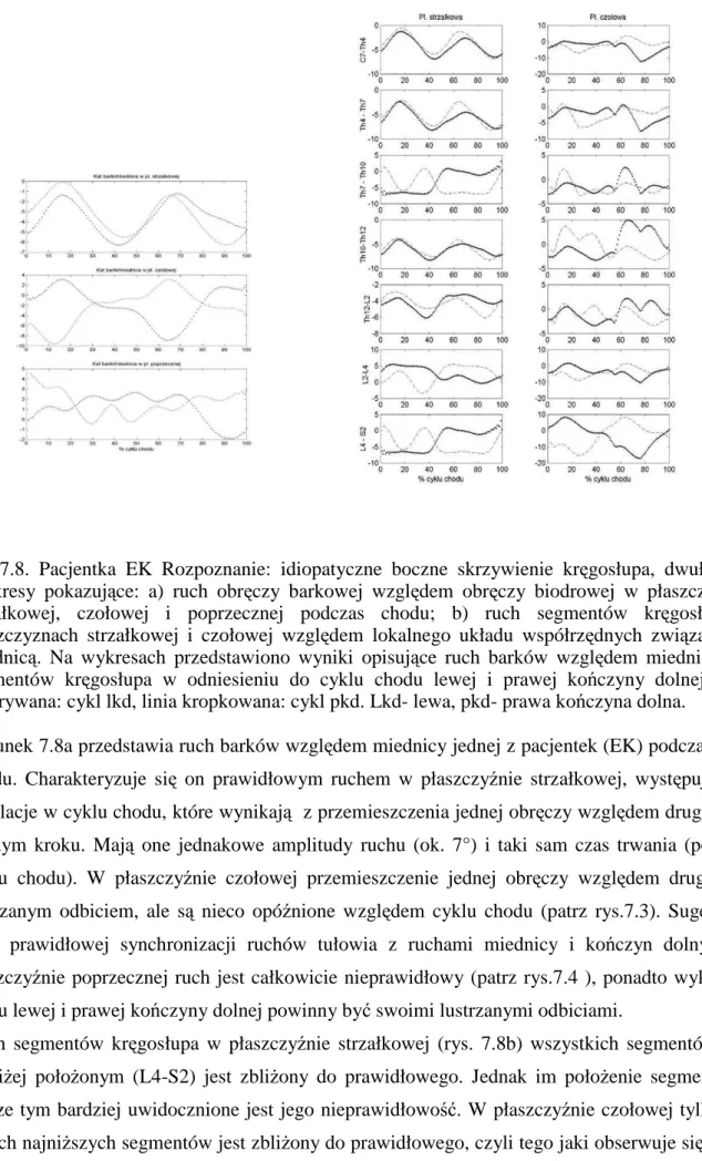 Rysunek 7.8a przedstawia ruch barków względem miednicy jednej z pacjentek (EK) podczas cyklu  chodu