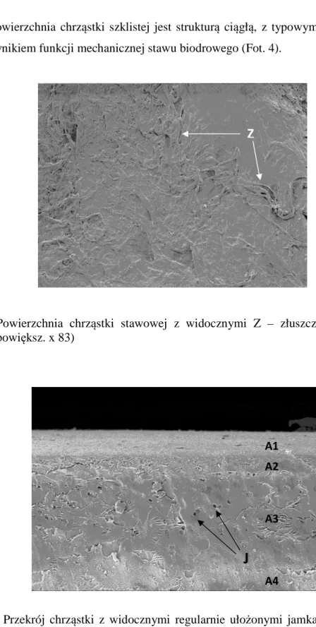 Fot. 4    Powierzchnia  chrząstki  stawowej  z  widocznymi  Z  –  złuszczeniami.    (SEM,  powiększ